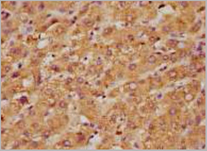 product-image-AAA18806_IHC2.jpg