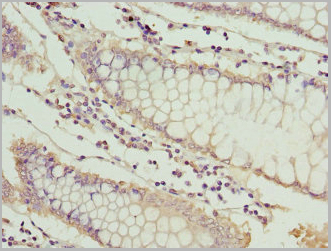 product-image-AAA18807_IHC.jpg