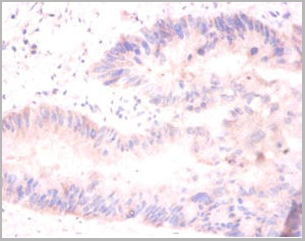 product-image-AAA18808_IHC2.jpg