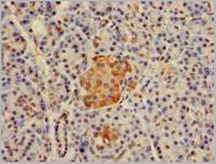 product-image-AAA18808_IHC3.jpg