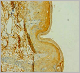 product-image-AAA18812_IHC.jpg