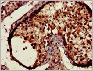 product-image-AAA18812_IHC2.jpg