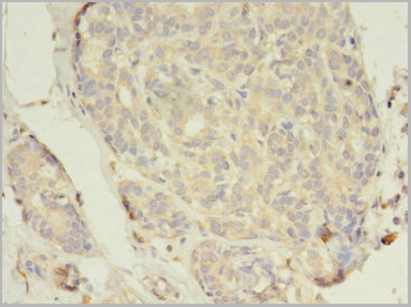 product-image-AAA18813_IHC2.jpg
