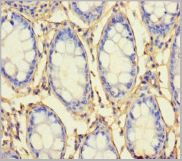 product-image-AAA18820_IHC.jpg