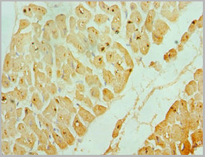 product-image-AAA18832_IHC2.jpg