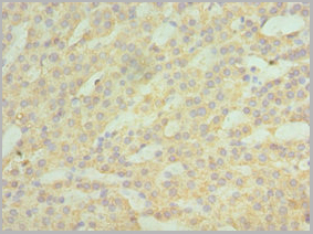 product-image-AAA18832_IHC3.jpg