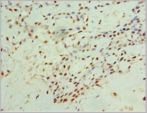product-image-AAA18833_IHC2.jpg