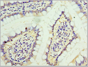 product-image-AAA18833_IHC3.jpg
