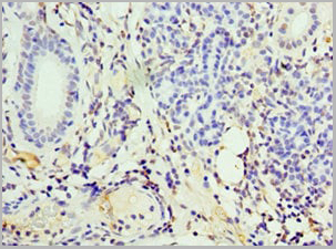 product-image-AAA18833_IHC4.jpg