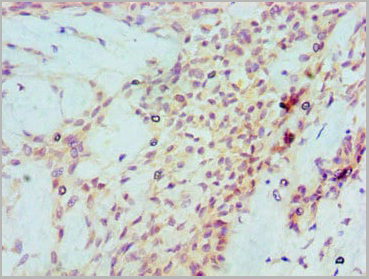 product-image-AAA18834_IHC3.jpg