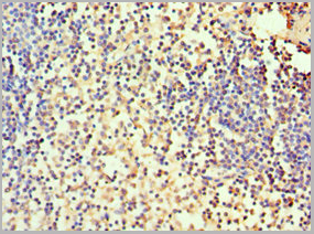 product-image-AAA18836_IHC2.jpg