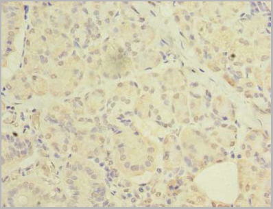 product-image-AAA18838_IHC2.jpg