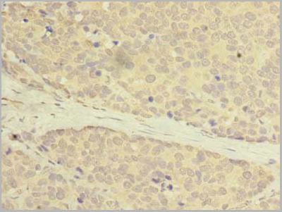 product-image-AAA18838_IHC3.jpg