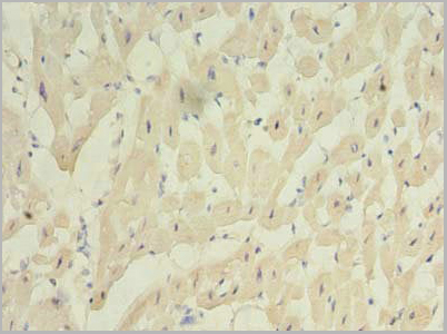 product-image-AAA18838_IHC4.jpg