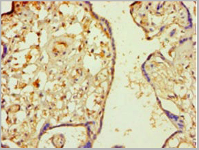 product-image-AAA18841_IHC2.jpg
