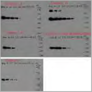 product-image-AAA18845_WB5.png