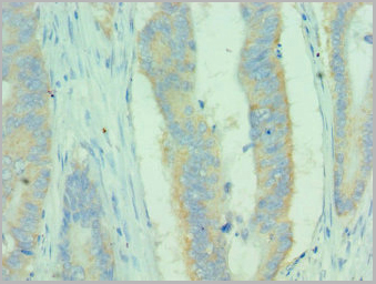 product-image-AAA18847_IHC2.jpg