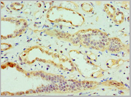 product-image-AAA18848_IHC2.jpg