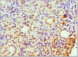 product-image-AAA18848_IHC3.jpg