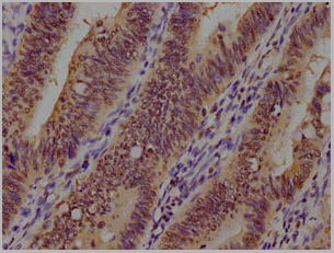product-image-AAA18852_IHC7.jpg