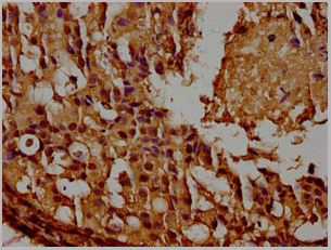 product-image-AAA18852_IHC8.jpg