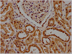 product-image-AAA18852_IHC9.jpg