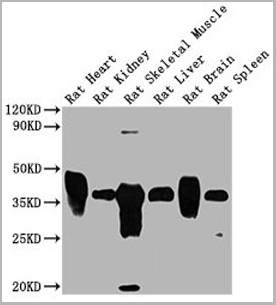 product-image-AAA18852_WB5.jpg
