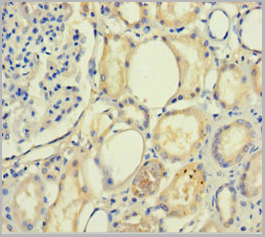 product-image-AAA18853_IHC.jpg