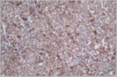 product-image-AAA18854_IHC.jpg