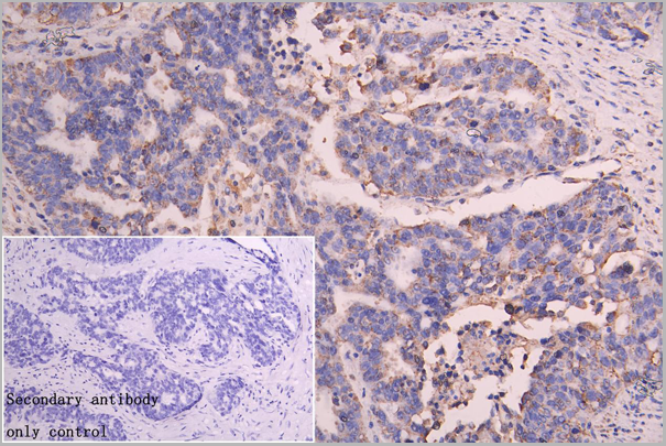product-image-AAA18856_IHC.png