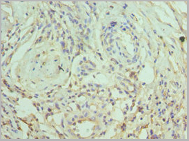 product-image-AAA18862_IHC2.jpg
