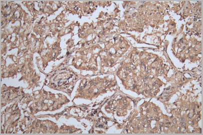product-image-AAA18862_IHC3.jpg