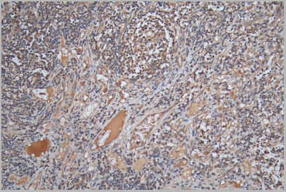 product-image-AAA18862_IHC4.jpg