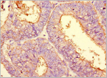 product-image-AAA18868_IHC6.jpg