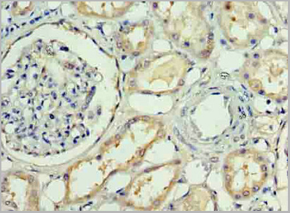 product-image-AAA18873_IHC2.jpg