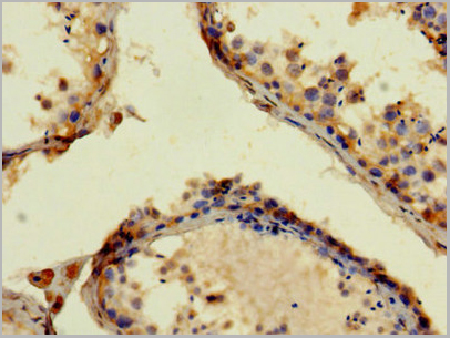 product-image-AAA18873_IHC3.jpg