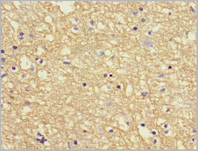product-image-AAA18873_IHC4.jpg