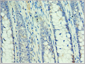 product-image-AAA18875_IHC3.jpg