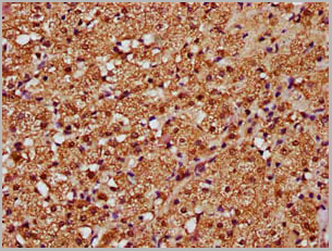 product-image-AAA18875_IHC5.jpg