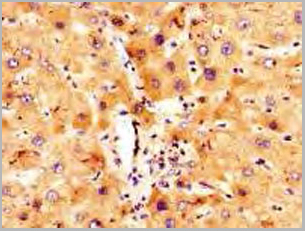 product-image-AAA18878_IHC.jpg