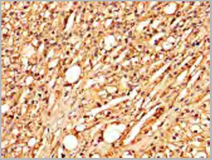 product-image-AAA18878_IHC2.jpg