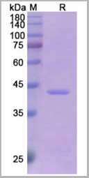 product-image-AAA18881_SDS_PAGE.jpg