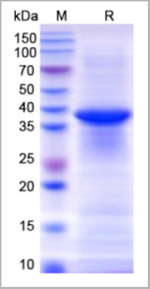 product-image-AAA18882_SDS_PAGE.jpg