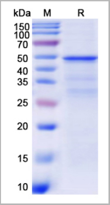 product-image-AAA18883_SDS_PAGE.jpg