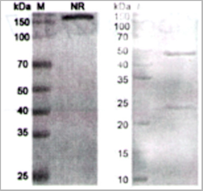 product-image-AAA18884_SDS_PAGE.jpg