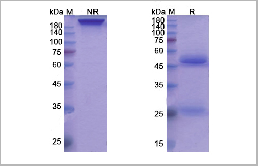 product-image-AAA18885_SDS_PAGE.jpg