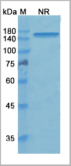 product-image-AAA18887_SDS_PAGE.jpg