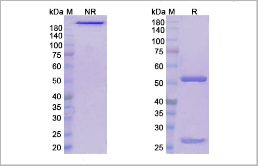 product-image-AAA18889_SDS_PAGE.jpg