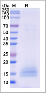 product-image-AAA18896_SDS_PAGE.jpg