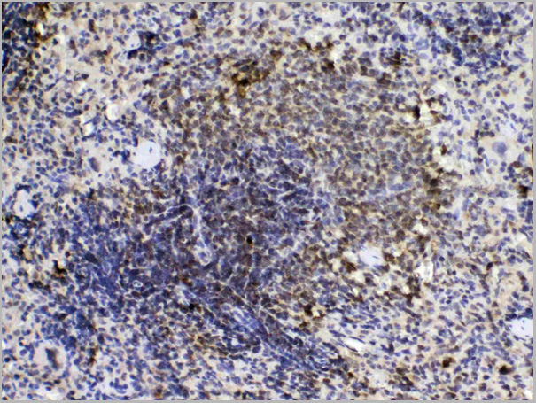 product-image-AAA19148_IHC3.jpg